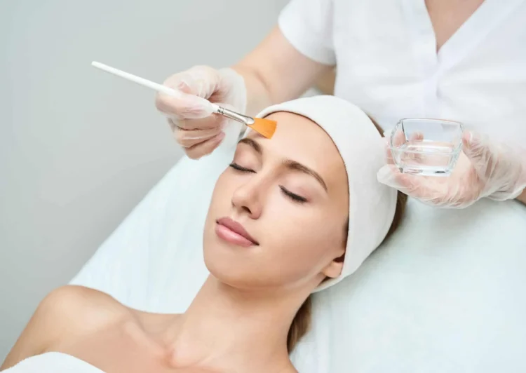 Chemical Peels or Facials